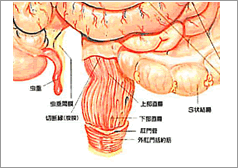 肛門がんイメージ図
