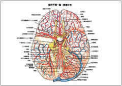 脳腫瘍イメージ図