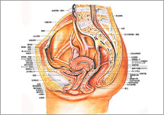 卵巣がんイメージ図